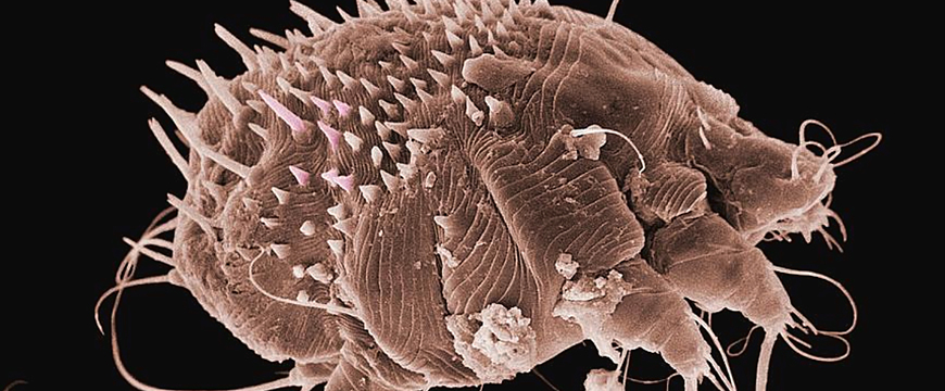Scabies - mite under a microscope