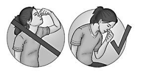 Illustration of person pinching bridge of nose and tilting head back to show what not to do if you have a nosebleed. Illustration of person sitting upright with head tipped forward and pinching nose, showing what to do if you have a nosebleed.